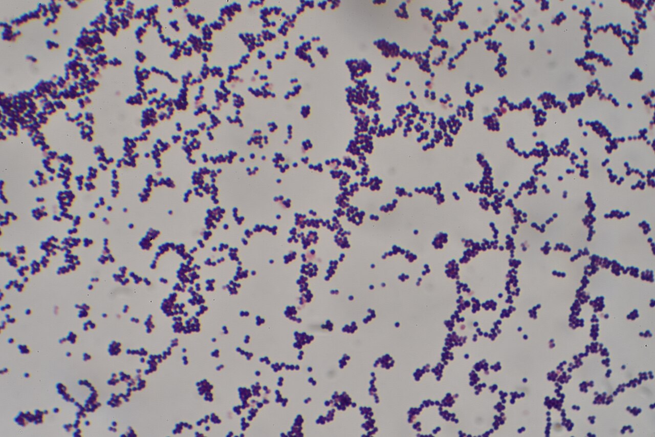 Gram-positive cocci in clusters, Staphylococcus aureus Gram stain